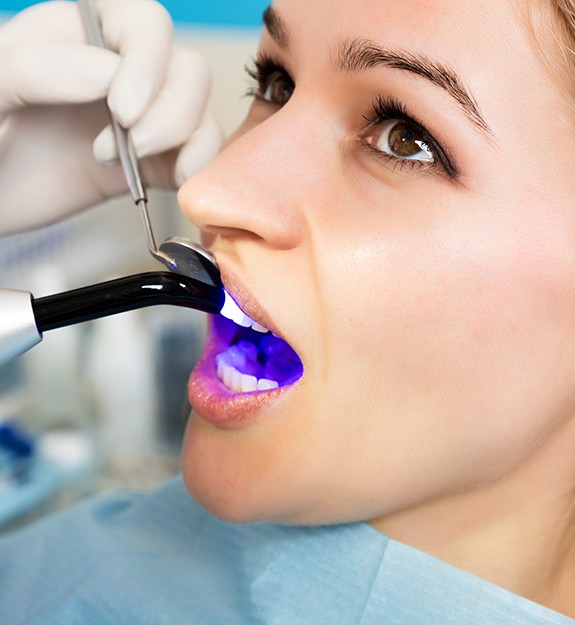 Dentist in Fort Worth curing cosmetic dental bonding resin on a patient's tooth