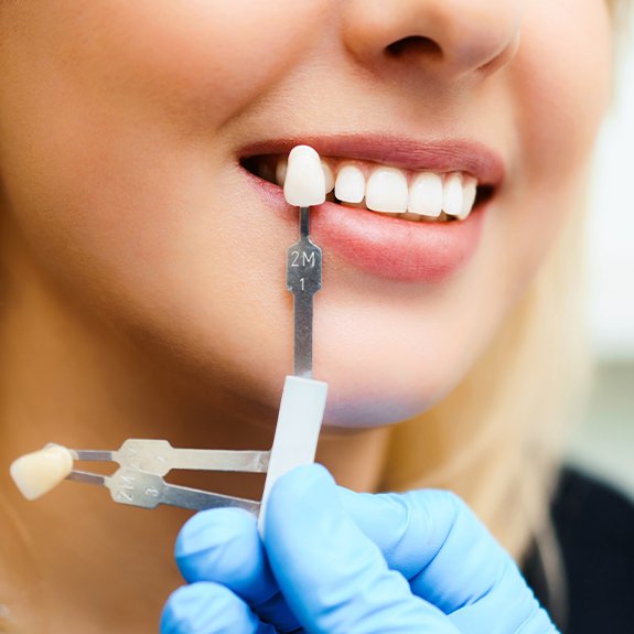 Woman's smile compared with porcelain veneer shade