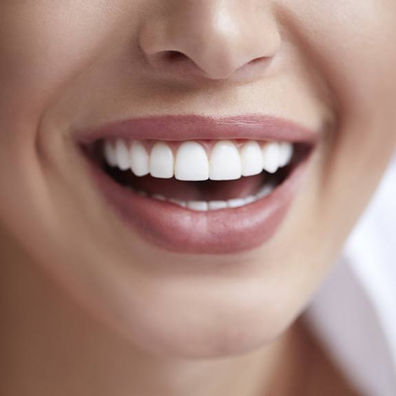 Patient's healthy smile after fluoride treatment