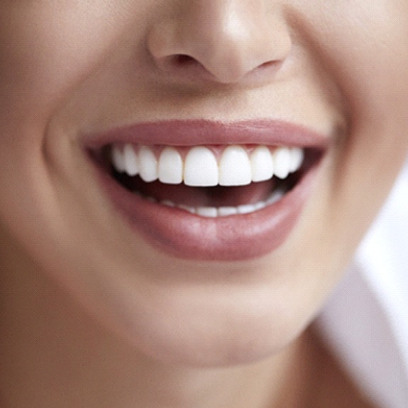 Closeup of smiling patient with veneers in Fort Worth
