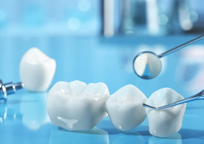 Close up of dental crowns